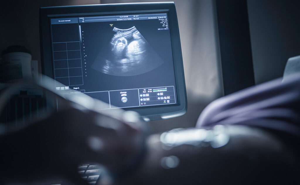 Pregnant woman having sonogram