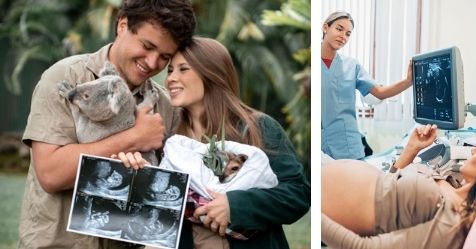 Bindi Irwin Pregnancy ultrasound