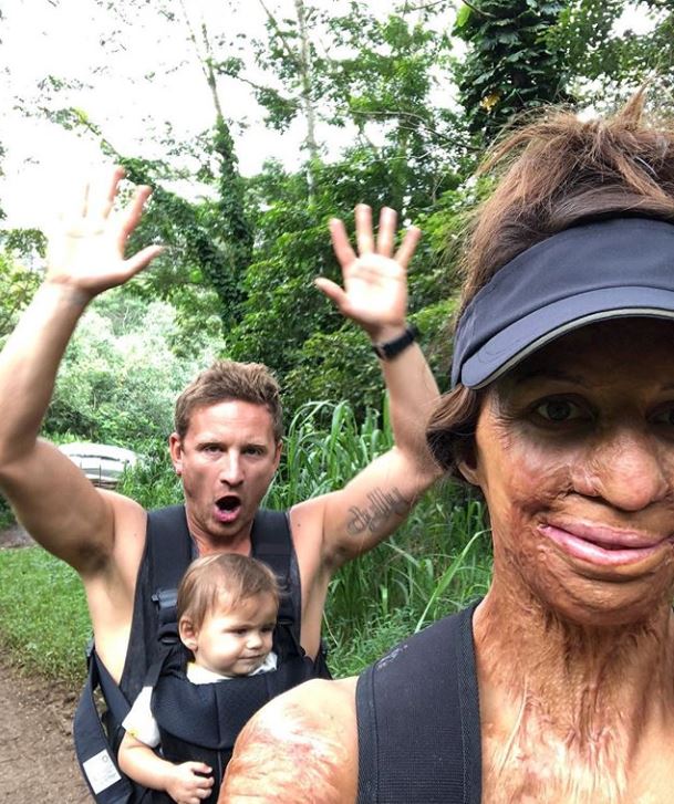 Turia Pitt