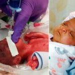 The incredible story behind the birth of the world’s smallest baby emerges – see the amazing pics