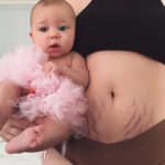 This mum is celebrating her post-baby stretch marks in the most beautiful way