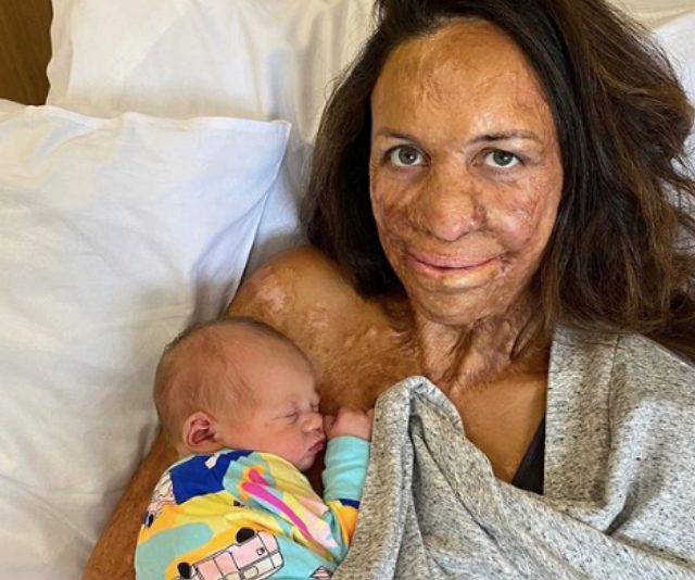 Turia Pitt