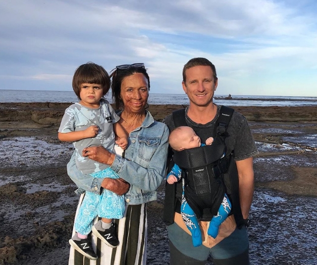 Turia Pitt