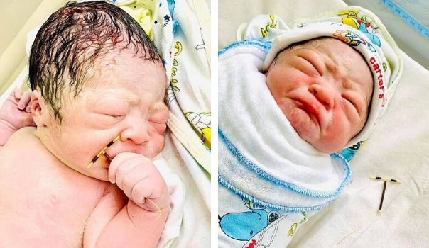 Incredible images show a newborn holding his mother’s contraceptive coil that failed to stop pregnancy