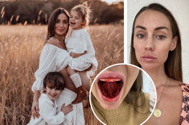 Influencer Krystal Hipwell gets real about her pregnancy health: Cellulite, varicose veins and bleeding gums