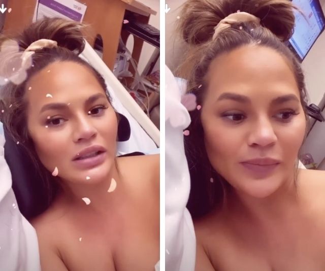 Chrissy Teigen hospitalised