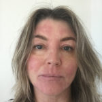 “Help, I’m allergic to my Christmas tree!”