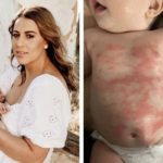 REAL LIFE: “My baby’s skin rash cleared up within 24 hours of using this supermarket moisturiser”