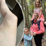 Twin mum-to-be Jana Pittman shares varicose veins and growing bump