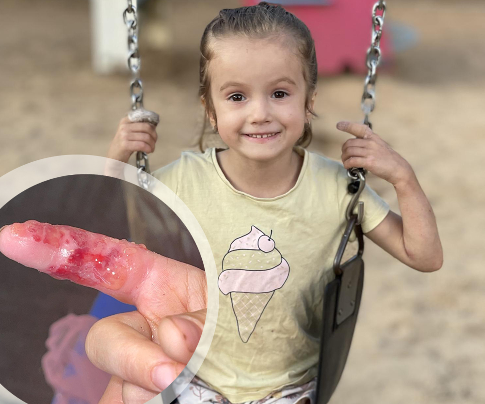 REAL LIFE: “Alivia’s fingers and feet are constantly oozing with blood and pus”