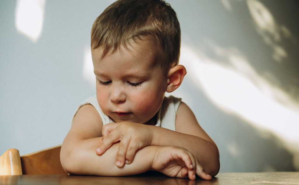 child at home at the table scratching a mosquito bite