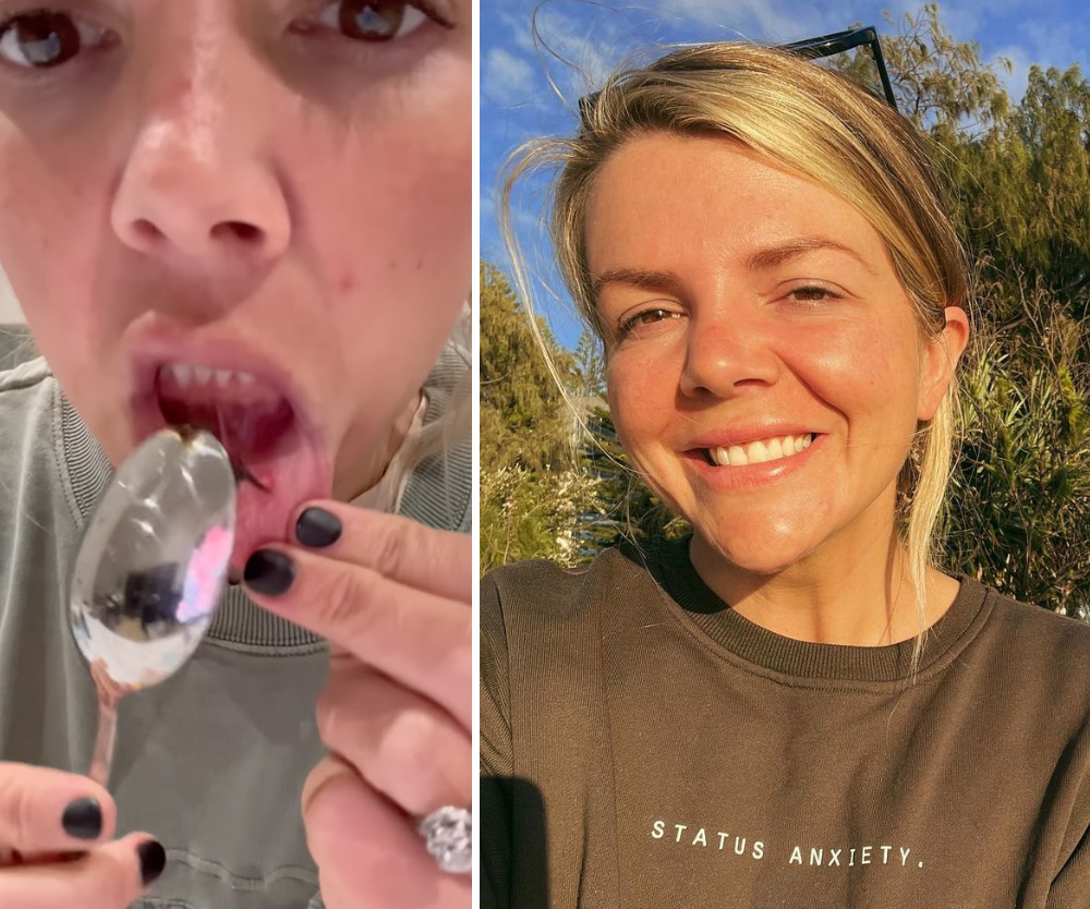Aussie mum’s hack for healing mouth ulcers with a common pantry ingredient goes viral