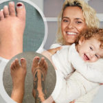 Ouch! Moana Hope’s postpartum feet are sweet relief from her pregnancy swelling