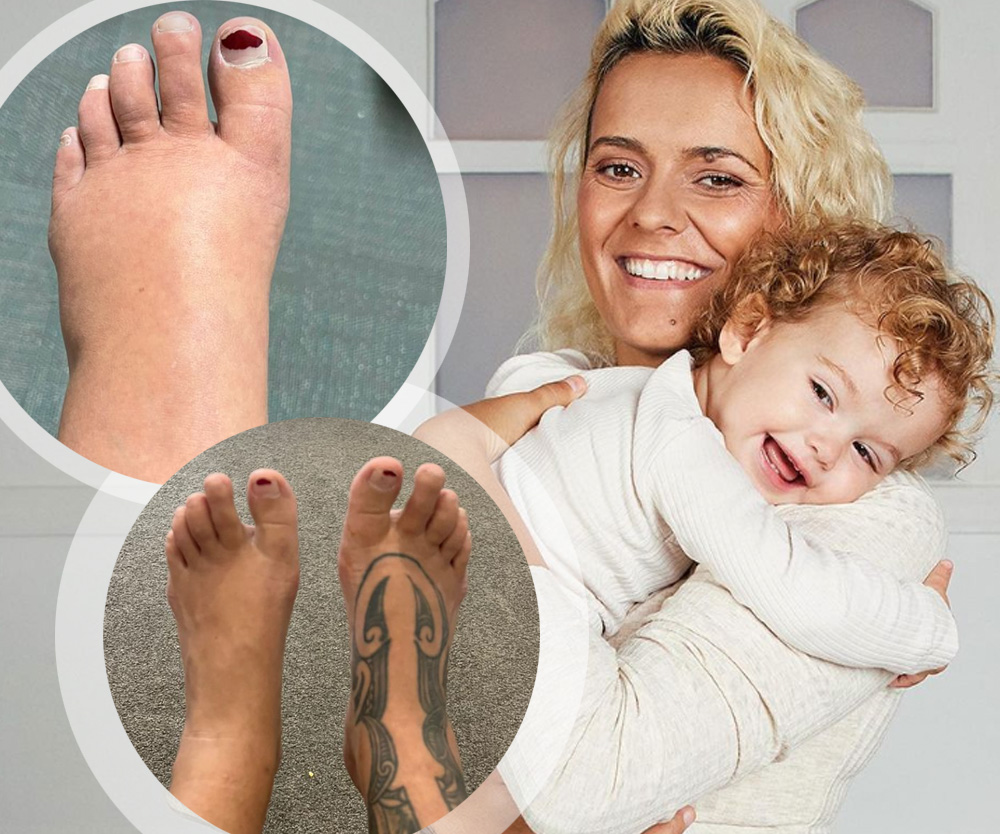 Ouch! Moana Hope’s postpartum feet are sweet relief from her pregnancy swelling