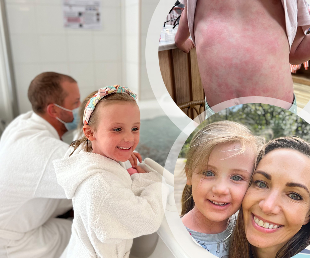 REAL LIFE: We went to France to try thermal spring water therapy for my daughter’s severe eczema