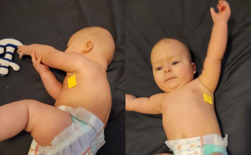 two images of the same baby wearing the Cubo Ai Smart Temp wearable monitor