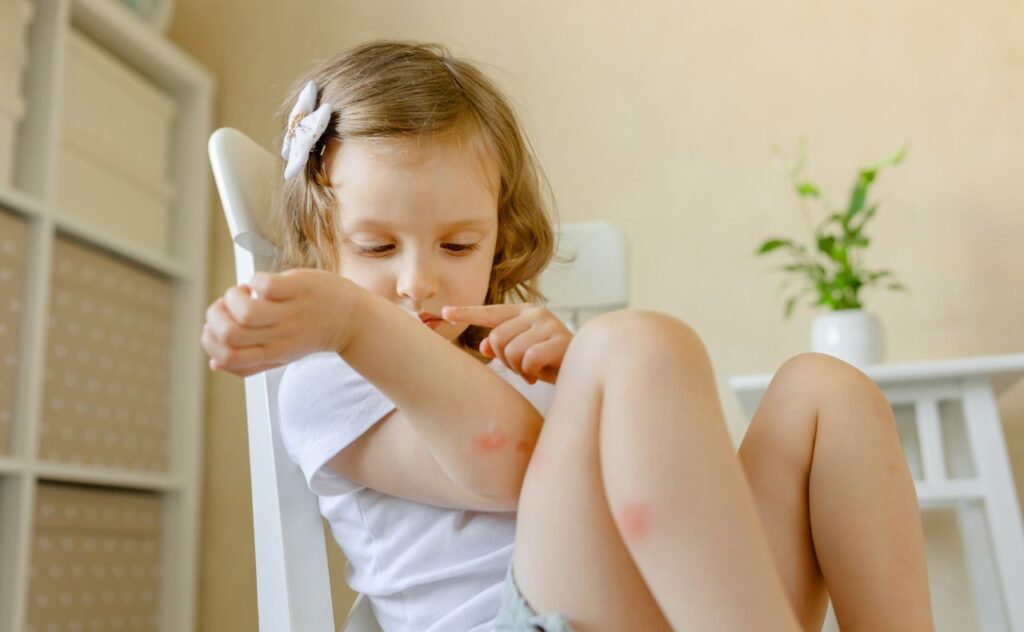 Small girl scratching at mosquito bites while sitting at dining table.