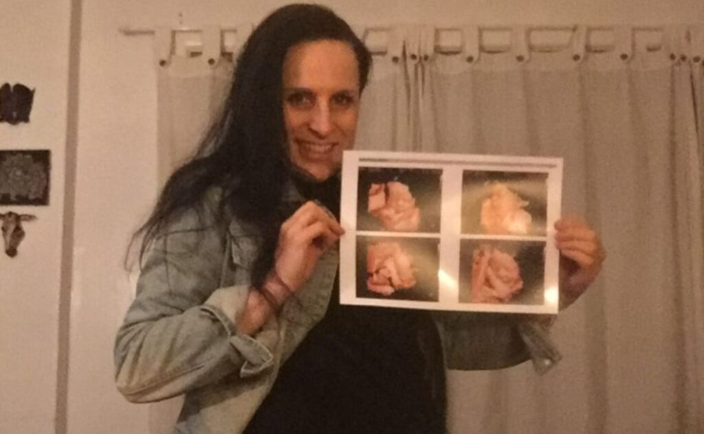 Real life: Age 46 pregnant woman holding up ultrasound images