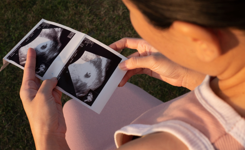 View looking over woman's shoulder as she looks at scan photos of early pregnancy
