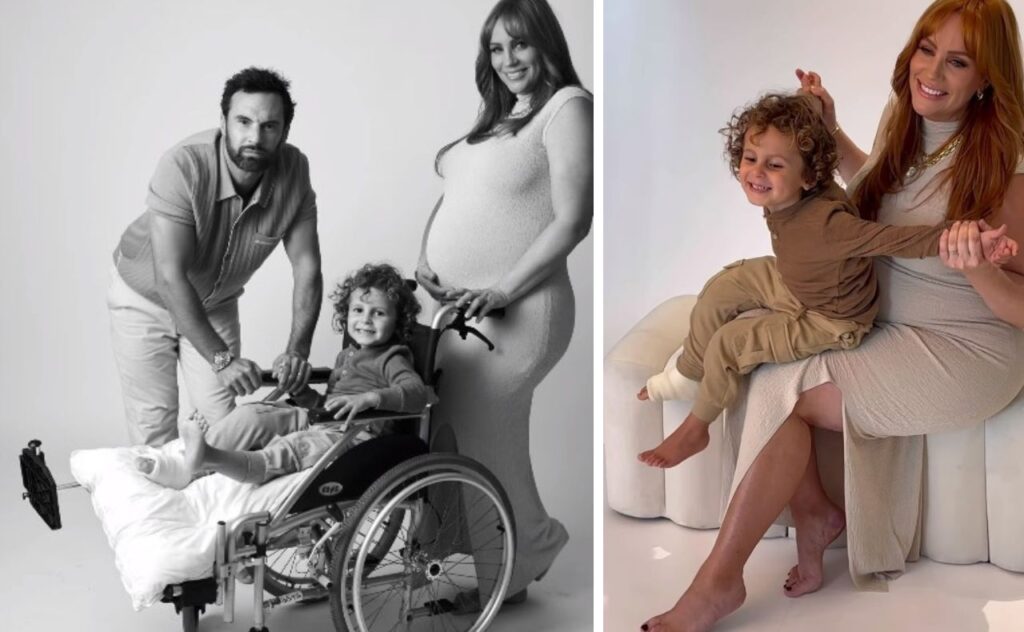 Jules Robinson Cam Merchant son broken leg