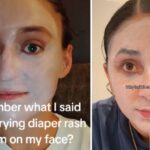 Nappy cream on face